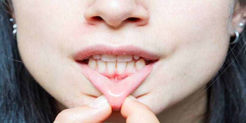 Understanding the Most Common Causes of Dry Mouth